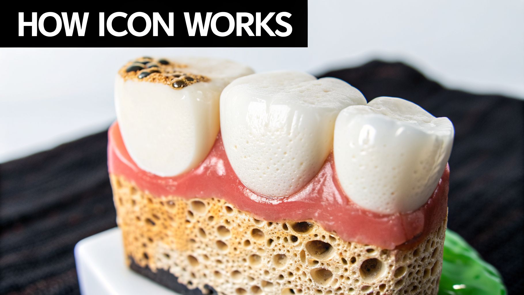 Detailed cross-section dental model showing three teeth, gums, and underlying bone structure.