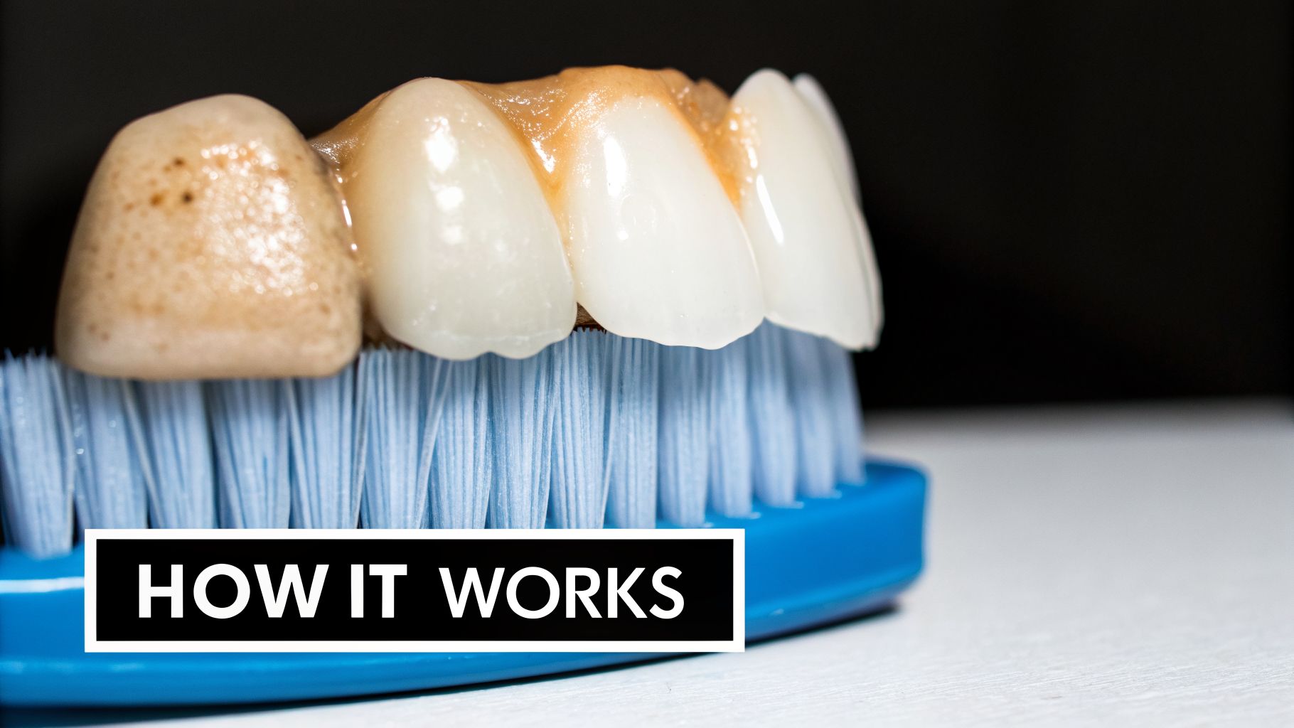 Close-up of a dental bridge with some stained teeth resting on a blue toothbrush.