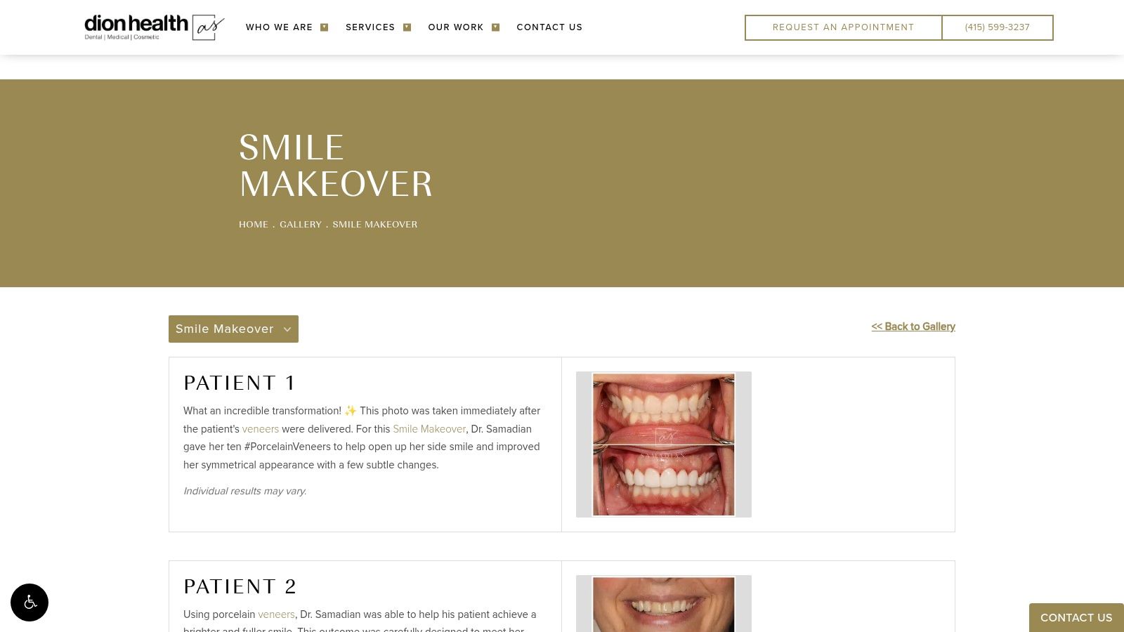 Samadian Cosmetic & Advanced Dentistry – Smile Makeover Gallery