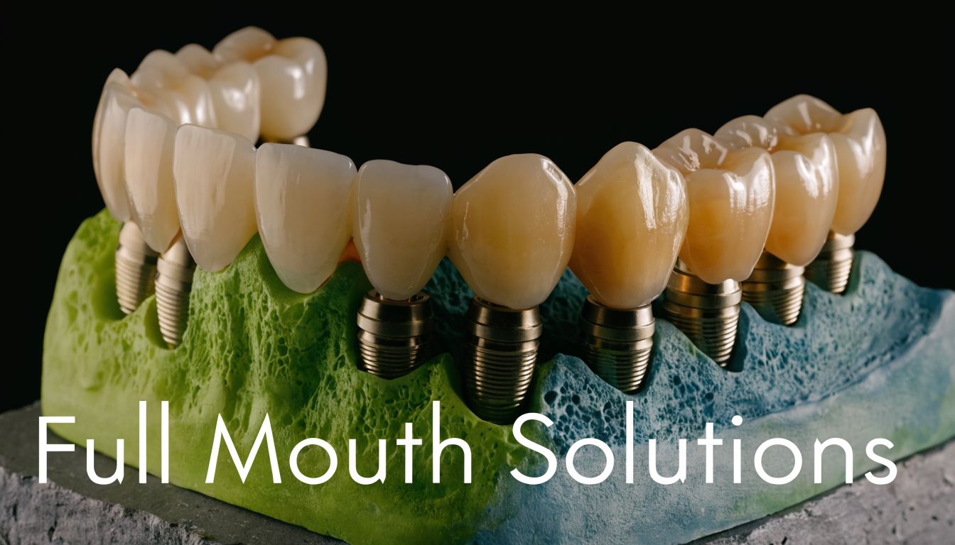 A detailed model of dental implants showcasing a full arch restoration set in a jaw model.